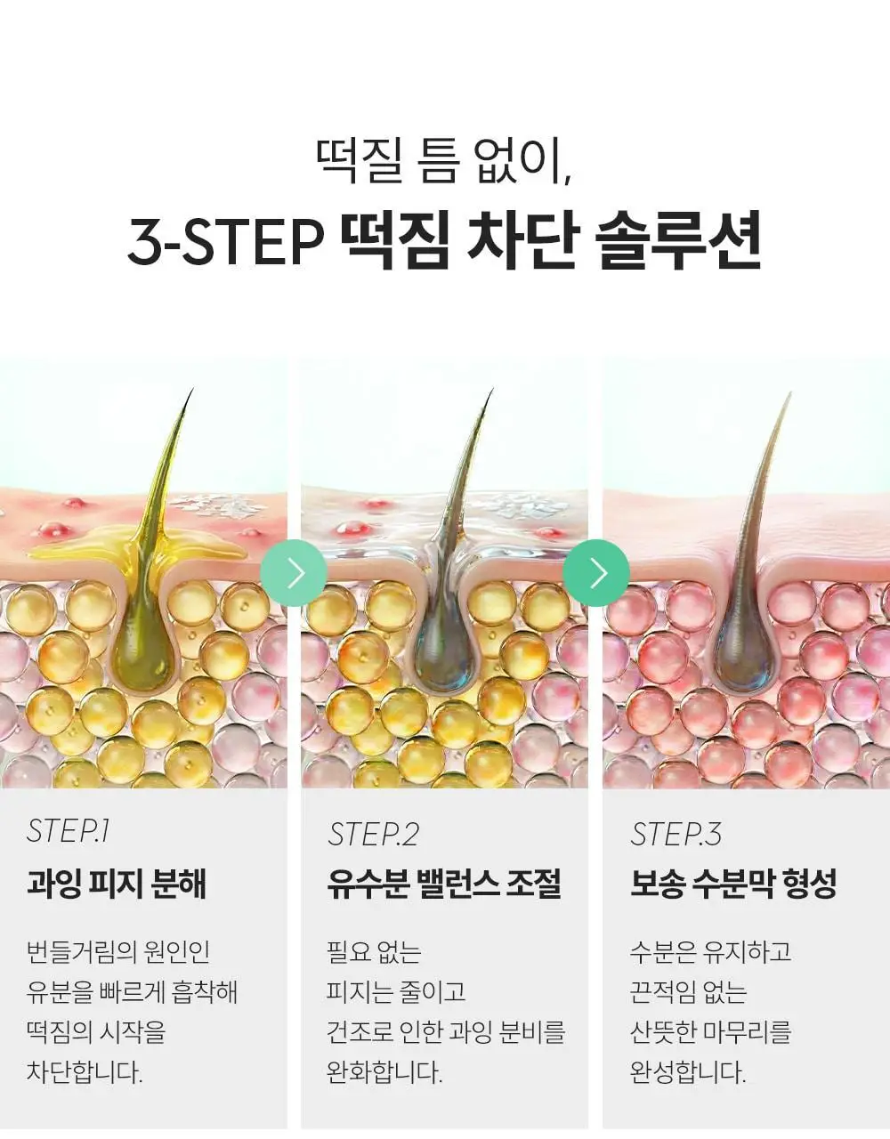 [지루성 두피케어] 낫포유 지성두피 트러블케어 미스트 80ml 기획 (+미니어처 30ml) 상세페이지 16